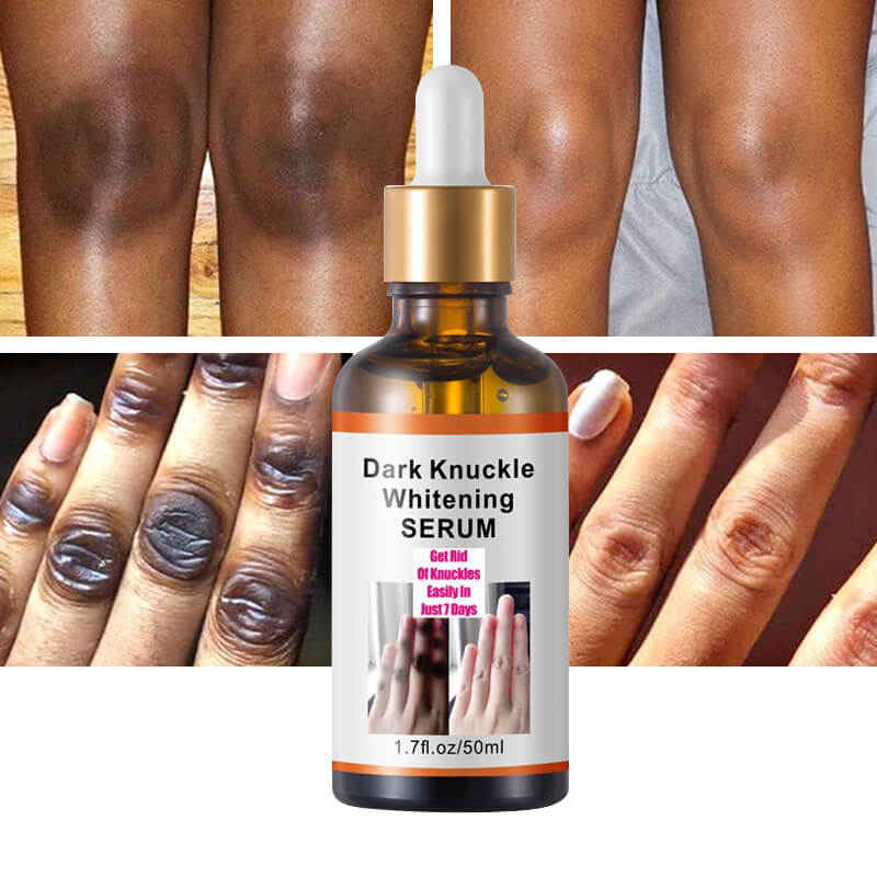 Dark knuckles serum whitening serum knuckle eraser elbow knee skin care