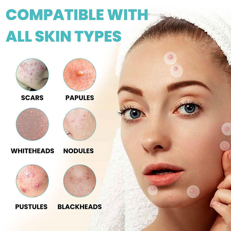 180pcs acne patch invisible cleansing soothing acne cover with essential oil