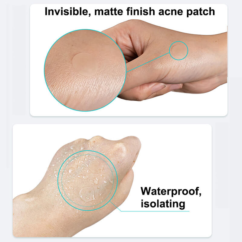 180pcs acne patch invisible cleansing soothing acne cover with essential oil