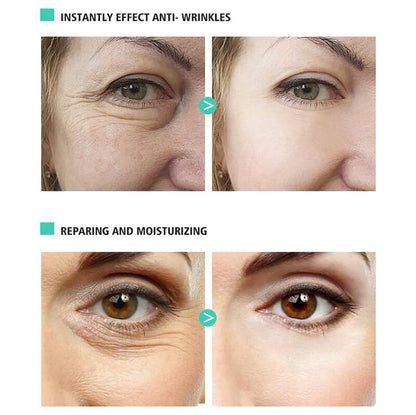 Face cream eye active retinol hyaluronic acid anti aging remove wrinkle 30ml