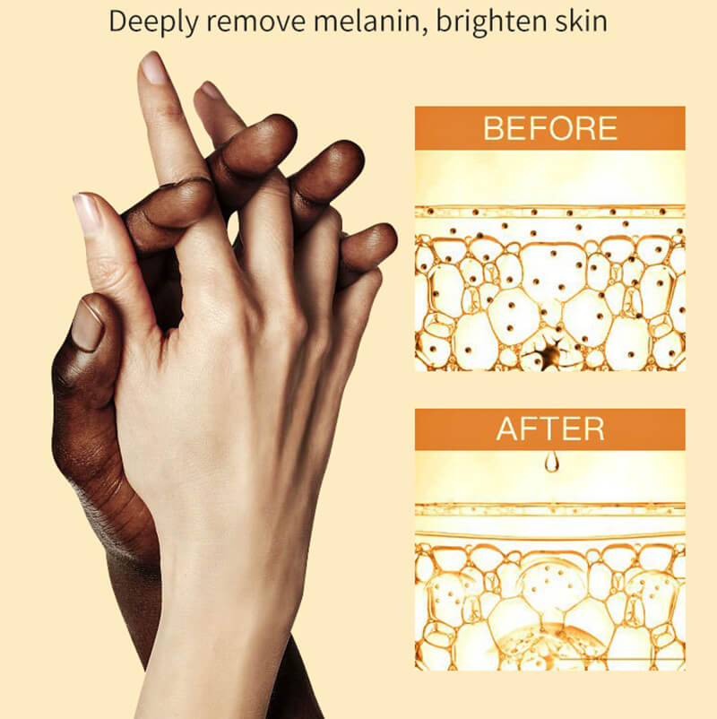 Dark knuckles serum whitening serum knuckle eraser elbow knee skin care