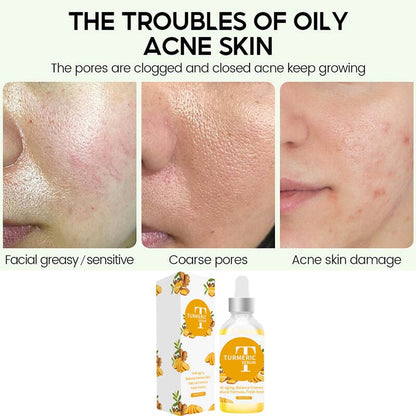 Face serum turmeric essence anti aging brighten remove dark spot 30ml