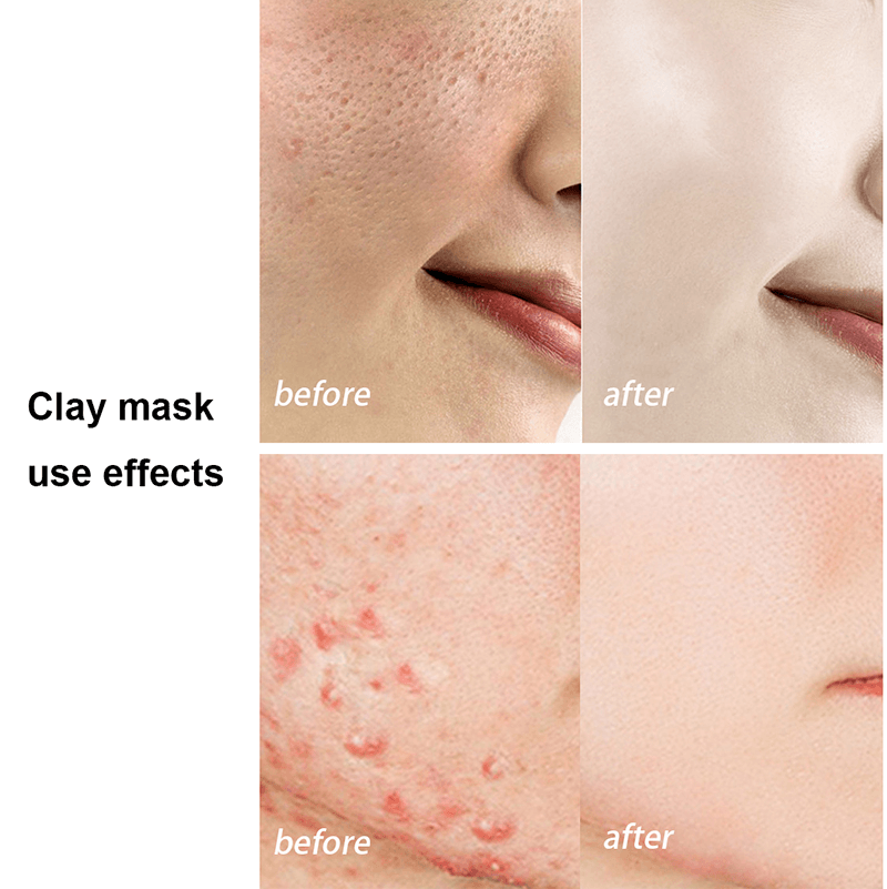 Clay mask kit cleansing mask face mask turmeric green tea anti-acne hydrating