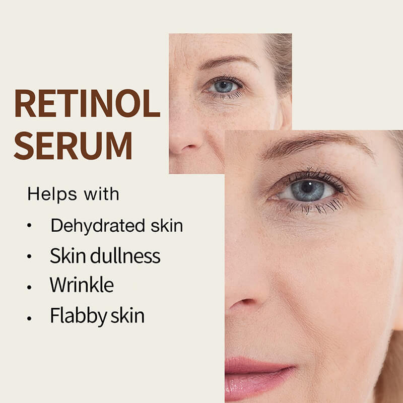 Face serum retinol anti aging remove dark spot nourishing hyaluronic acid 30ml